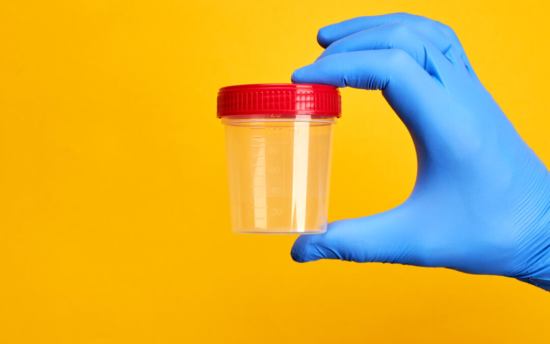 Non-DOT Drug and Alcohol Testing in County Government