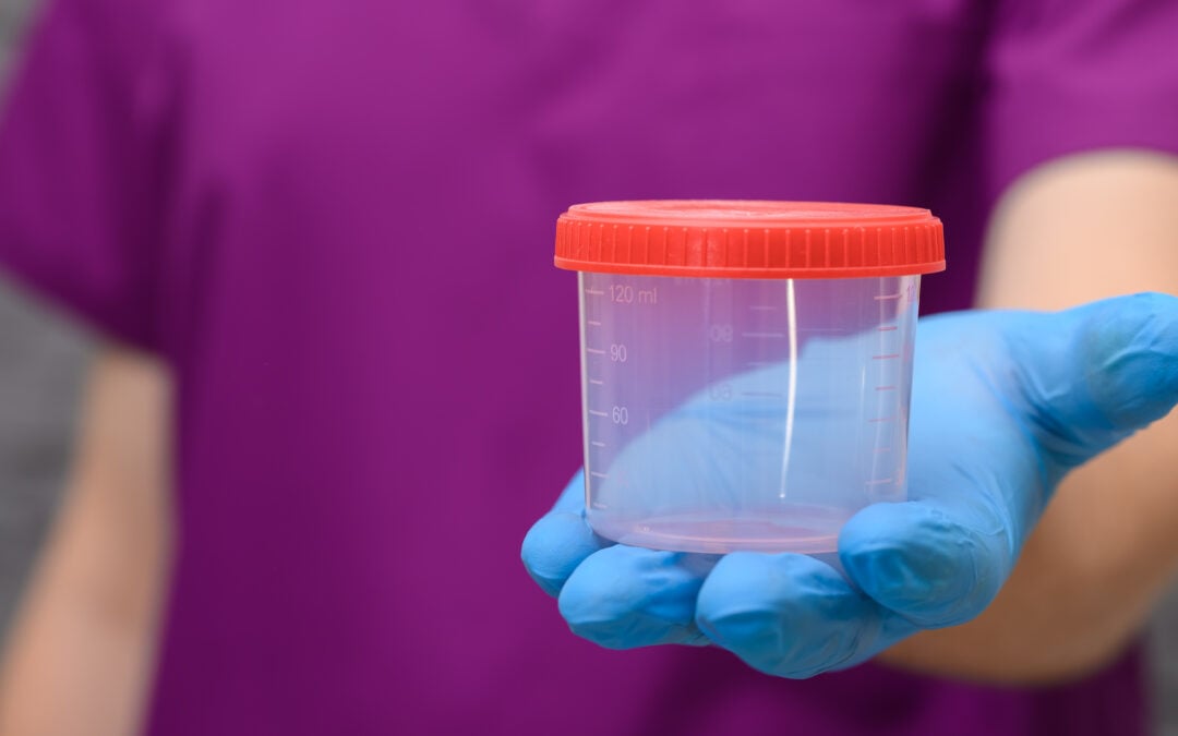 When Can an “Alternate” Be Substituted on the List of Employees Selected for Random Drug & Alcohol Testing?